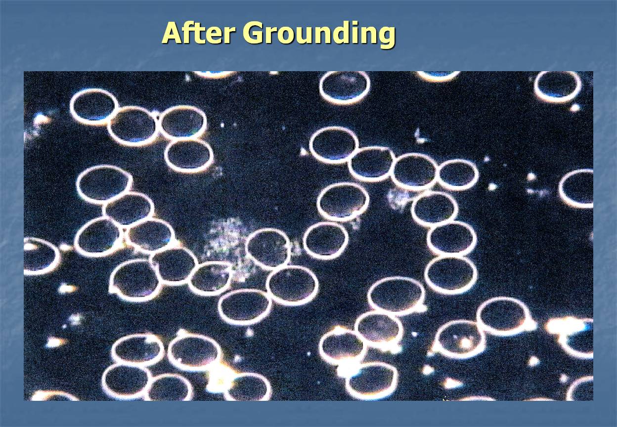 Earthing can thin the blood - after grounding