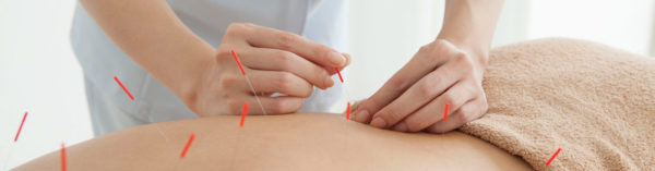 acupuncture as an alternative pain reliever to opiods