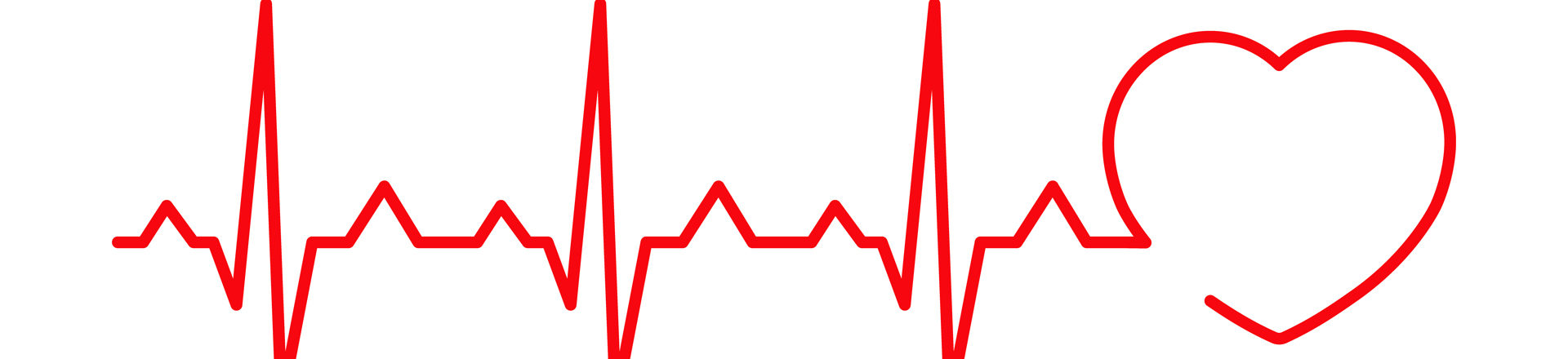 irregular heartbeat ekg - when to worry about heart palpitations