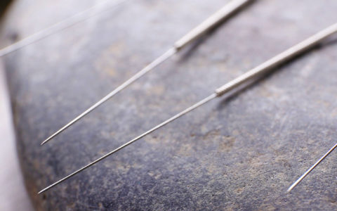 acupuncture needles resting on a stone